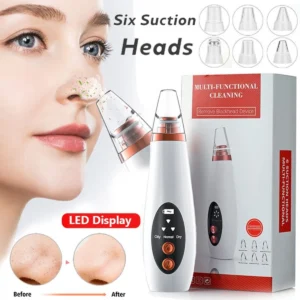 Blackheads Remover